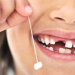 آیا دندان شیری ریشه دارد؟ | بهترین دندانپزشک اصفهان