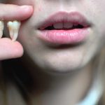پس از کشیدن دندان، چه اتفاقی برای آن می افتد؟