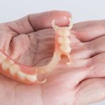 پروتز پارسیل دندان چیست؟ | بهترین دندانپزشک اصفهان