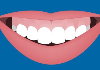 روش‌های اصلاح Gummy Smile