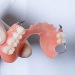 چرا از پروتزهای پارسیل موقت استفاده می کنند؟ | بهترین دندانپزشک اصفهان