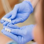 مراحل اصلی قالب گیری ایمپلنت | بهترین دندانپزشک اصفهان