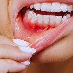 ارتباط بین بیماری‌های لثه و بیماری‌های سیستمیک | بهترین دندانپزشک اصفهان | دکتر سید حمید رضویان