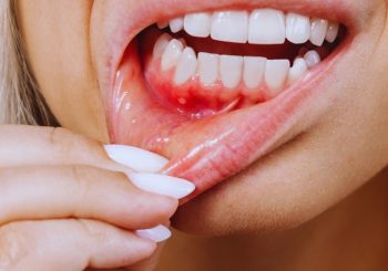 ارتباط بین بیماری‌های لثه و بیماری‌های سیستمیک