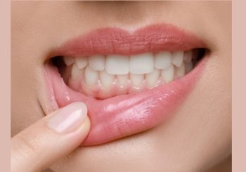 افزایش ماندگاری درمان‌ها در بیماران با مشکلات لثه‌ای با بیومواد جدید