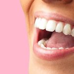 انواع پیوند لثه | بهترین دندانپزشک اصفهان