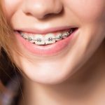 اهمیت اولویت ایمپلنت و ارتودنسی | بهترین دندانپزشک اصفهان | دکتر سید حمید رضویان