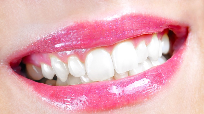 بررسی روش های مختلف سفید کردن دندان | بهترین دندانپزشک اصفهان