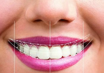 تاثیر هوش مصنوعی در طراحی لبخند دیجیتال