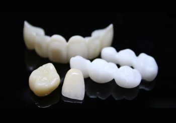 جایگزینی روکش‌ PMF با روکش زیرکونیا