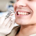 مراقبت‌های پس از بروساژ دندان | بهترین دندانپزشک اصفهان