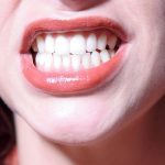 روش پیشگیری و درمان‌های خانگی سیاه شدن لثه | بهترین دندانپزشک اصفهان