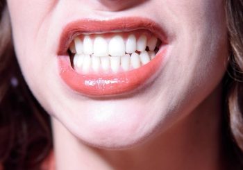 روش پیشگیری و درمان‌های خانگی سیاه شدن لثه