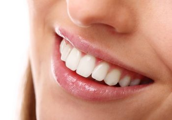 دندانپزشکی زیبایی برای افزایش اعتماد به نفس