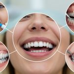 رابطه علم اکلوژن با موفقیت و طول عمر درمان‌های ترمیمی و زیبایی | بهترین دندانپزشک اصفهان | دکتر سید حمید رضویان
