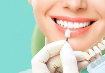 راهنمای انتخاب ونیر کامپوزیت یا لمینت سرامیکی