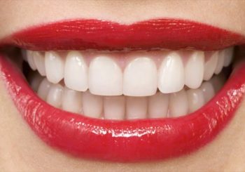 روش های سفید کردن دندان در دندانپزشکی زیبایی