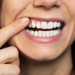 روش های مختلف جراحی لثه | بهترین دندانپزشک اصفهان