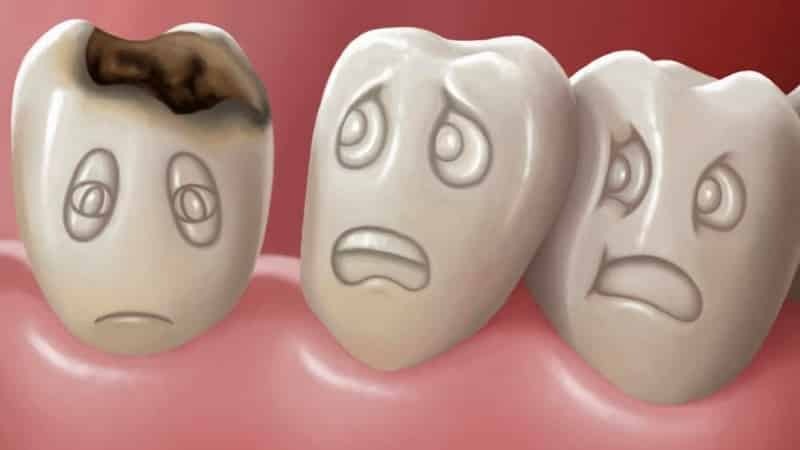 عوامل خطرزا در پوسیدگی دندان | بهترین دندانپزشک اصفهان