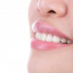 متدهای کم تهاجمی در اصلاح طرح لبخند | بهترین دندانپزشک اصفهان | دکتر سید حمید رضویان |