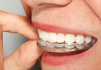 مزایا و معایب استفاده از نایت گارد