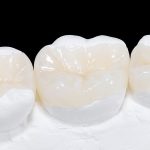 ملاک انتخاب بهترین ماده برای ترمیم دندان | بهترین دندانپزشک اصفهان