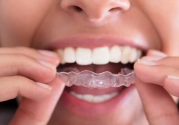 موارد استفاده از انواع نایت گارد یا محافظ دندان