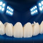 موارد استفاده از روکش دندان زیرکونیا | بهترین دندانپزشک اصفهان | دکتر سید حمید رضویان