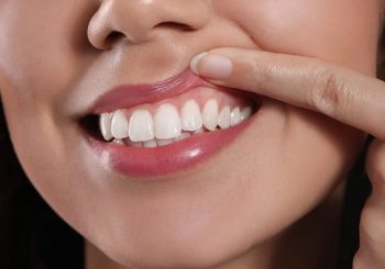 نقش مهم سلامت لثه و زیبایی لبخند