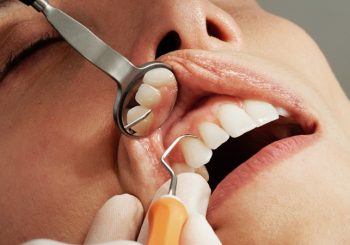 نقش پریودنتیست در طراحی لبخند