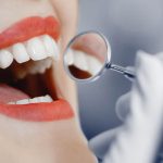 نکات مراقبتی برای شکستن یا افتادن لمینت دندان | بهترین دندانپزشک اصفهان
