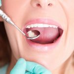 نکات مراقبتی پس از پر کردن دندان | بهترین دندانپزشک اصفهان | دکتر سید حمید رضویان
