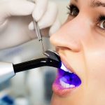 کاربردهای باندینگ کامپوزیت دندان | بهترین دندانپزشک اصفهان | دکتر سید حمید رضویان