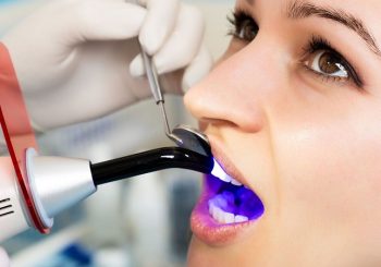 کاربردهای باندینگ کامپوزیت دندان